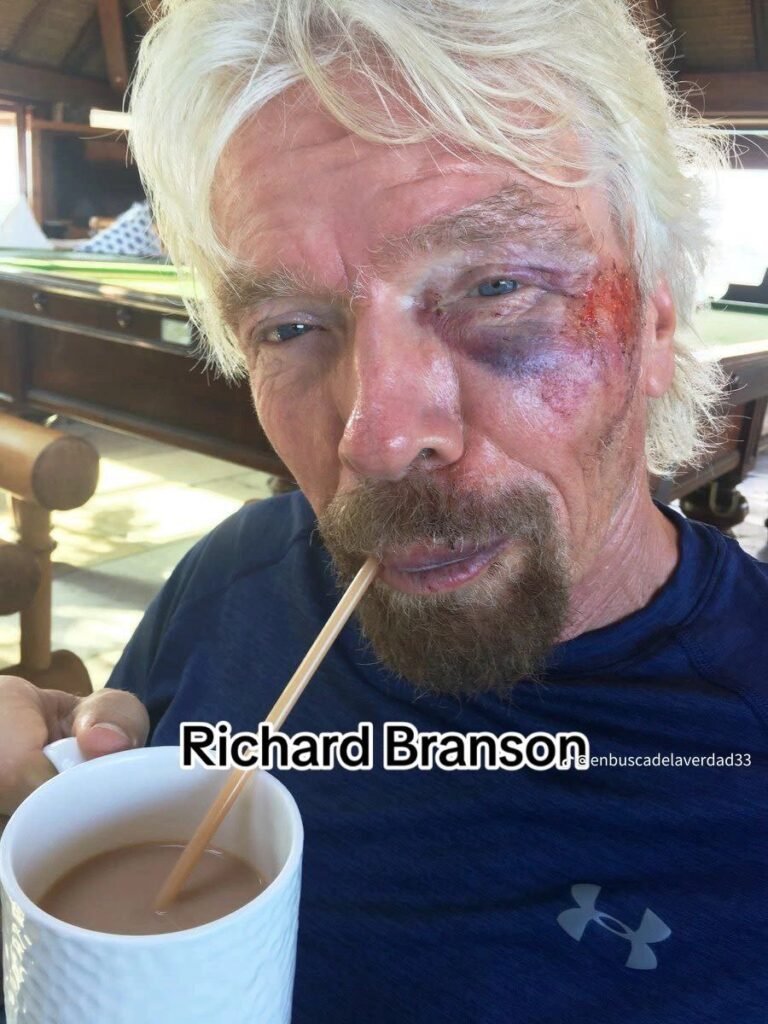 Ojos Panda (Black Eye Pedo and Panda Eyes)