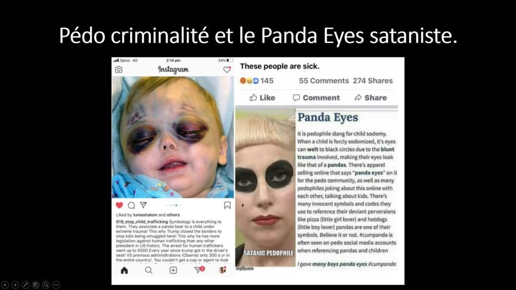 Ojos Panda (Black Eye Pedo and Panda Eyes)