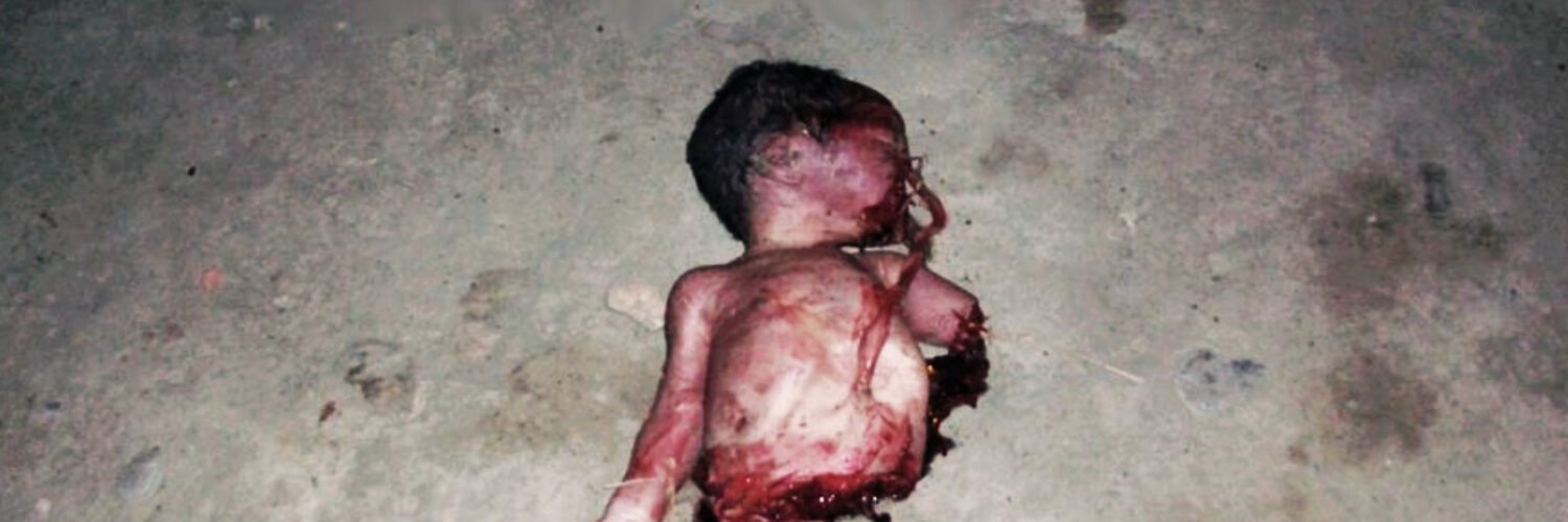 Planned Parenthood. Aborto. Bebé descuartizado.