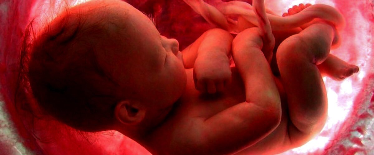 El aborto fue la principal causa mundial de muerte en 2024 con más de 45 millones de muertos (alertadigital.com).