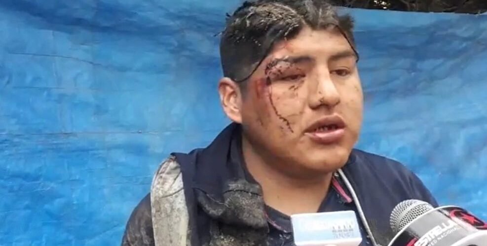 Berglogio. Prevost. Pachamama.